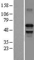 IRF7 Human Over-expression Lysate