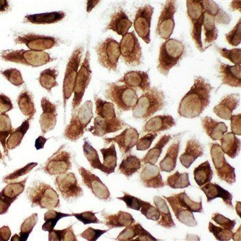 TRAM1 Rabbit Polyclonal Antibody