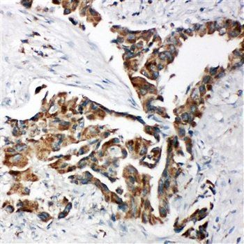 TRAM1 Rabbit Polyclonal Antibody