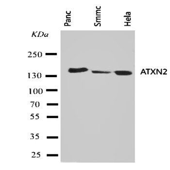 ATX2/ATXN2 Rabbit Polyclonal Antibody