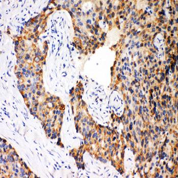 Caspase-12/CASP12/12 Rabbit Polyclonal Antibody