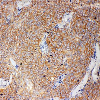 Caspase-12/CASP12/12 Rabbit Polyclonal Antibody