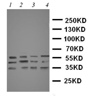 Caspase-12/CASP12/12 Rabbit Polyclonal Antibody