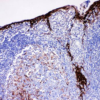 Cystatin A/CSTA Rabbit Polyclonal Antibody