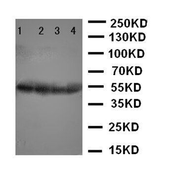 Cystatin A/CSTA Rabbit Polyclonal Antibody