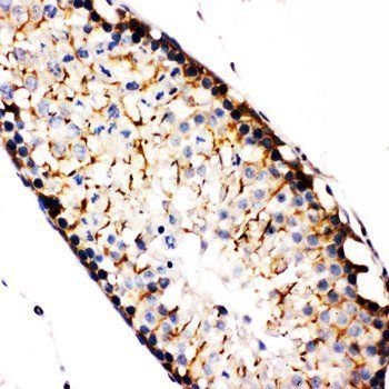 NAK/TBK1 Rabbit Polyclonal Antibody