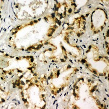 NAK/TBK1 Rabbit Polyclonal Antibody