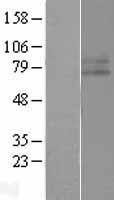 IFNGR1 Human Over-expression Lysate
