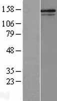 COL5A2 Human Over-expression Lysate