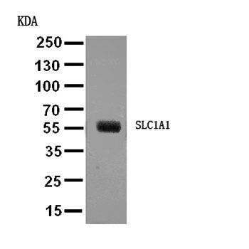 EAAT3/SLC1A1 Rabbit Polyclonal Antibody