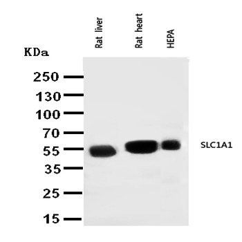 EAAT3/SLC1A1 Rabbit Polyclonal Antibody