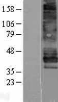 Endothelin B Receptor (EDNRB) Human Over-expression Lysate