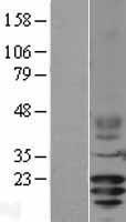 CD3G Human Over-expression Lysate