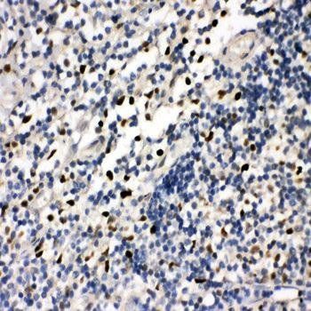 FLI1 Rabbit Polyclonal Antibody