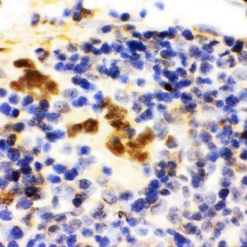 FLI1 Rabbit Polyclonal Antibody