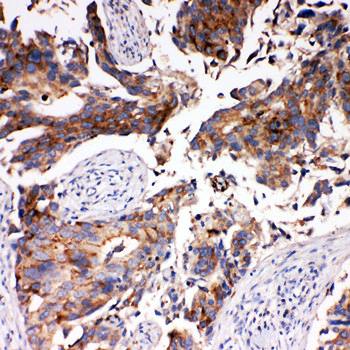 Monocarboxylate transporter 5 SLC16A4 Rabbit Polyclonal Antibody