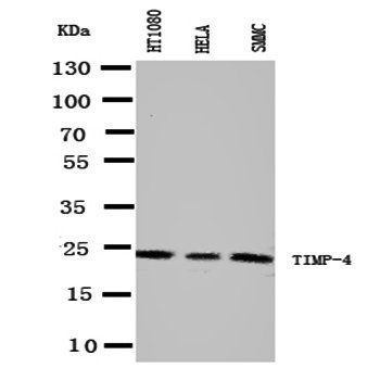 Metalloproteinase inhibitor 4 TIMP4 Rabbit Polyclonal Antibody