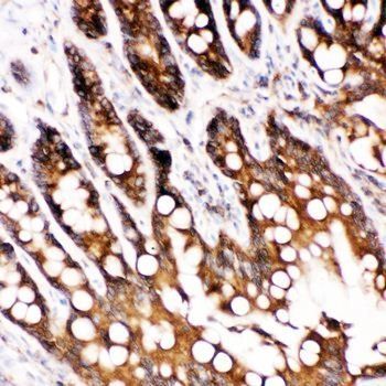 Caspase-6/CASP6 Rabbit Polyclonal Antibody