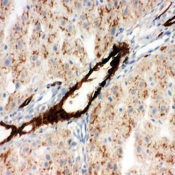 Adiponectin/ADIPOQ Rabbit Polyclonal Antibody