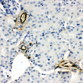 Adiponectin/ADIPOQ Rabbit Polyclonal Antibody