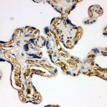 Adiponectin/ADIPOQ Rabbit Polyclonal Antibody