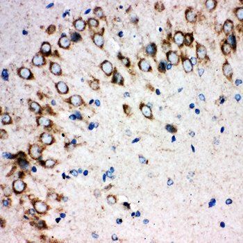 Sonic Hedgehog/SHH Rabbit Polyclonal Antibody