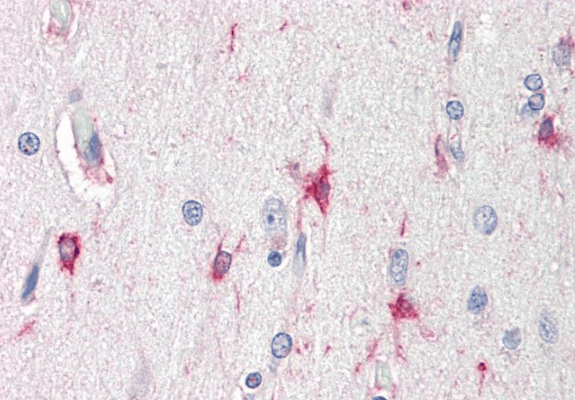 Goat anti-BAG3 Antibody