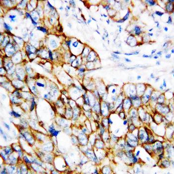 beta Catenin/CTNNB1 Rabbit Polyclonal Antibody
