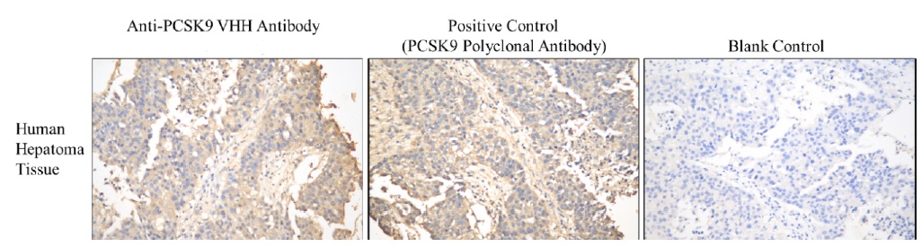 PCSK9 VHH antibody