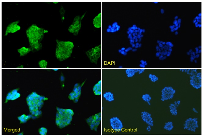 PCSK9 VHH antibody