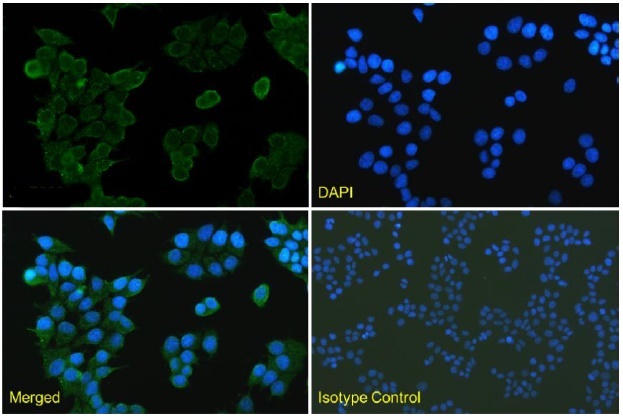 EGFR VHH antibody