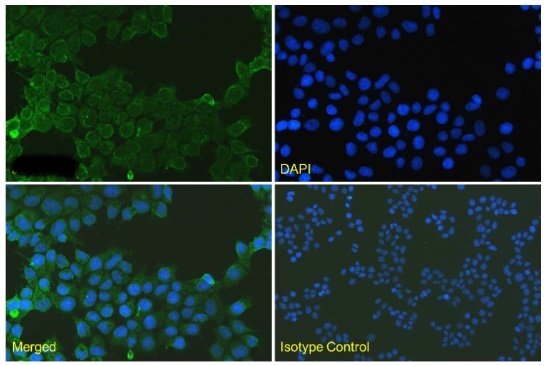 Human Epidermal Growth Factor Receptor 2 (Her2) Antibody