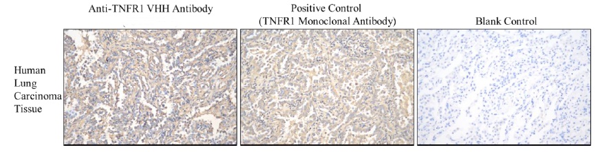Human Tumor Necrosis Factor Receptor 1 (hTNFR1) Antibody