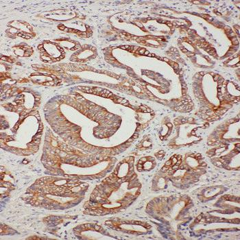 TNFAIP8L3 Rabbit Polyclonal Antibody