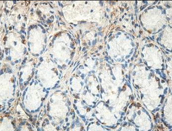MYO1F Rabbit Polyclonal Antibody