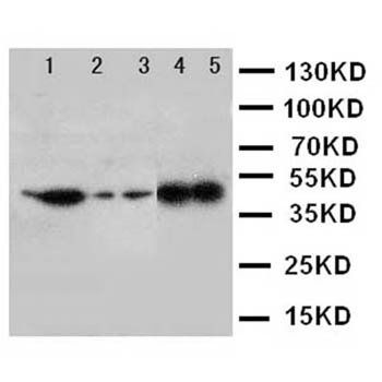 Decorin/DCN Rabbit Polyclonal Antibody