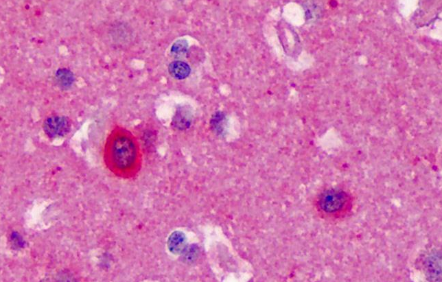 NOS1 Antibody