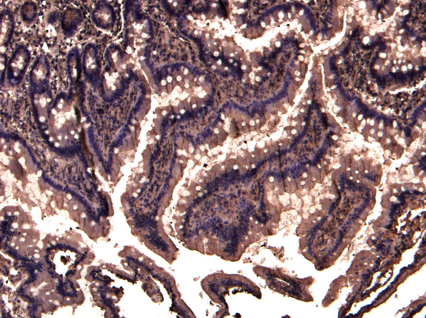 Goat anti-TRIM5 / RNF88 Antibody