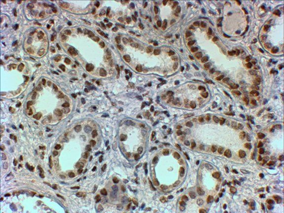 PTBP1/PTB Antibody