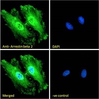 Arrestin beta 2 Antibody
