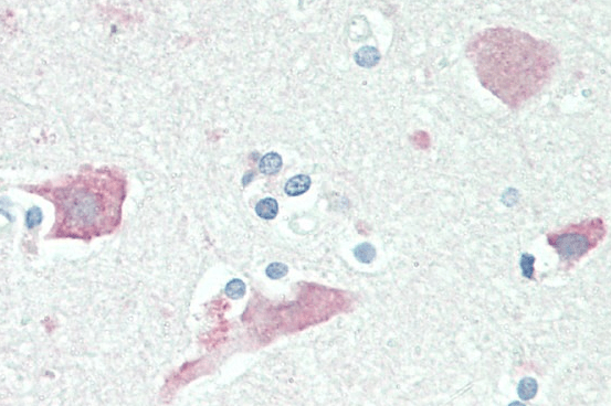 Neuroserpin Antibody