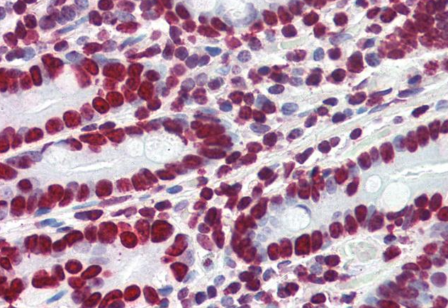 HMGA1 Antibody