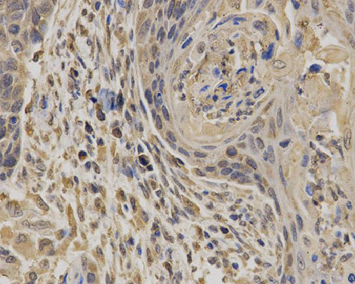 EPHX1 Rabbit Polyclonal Antibody