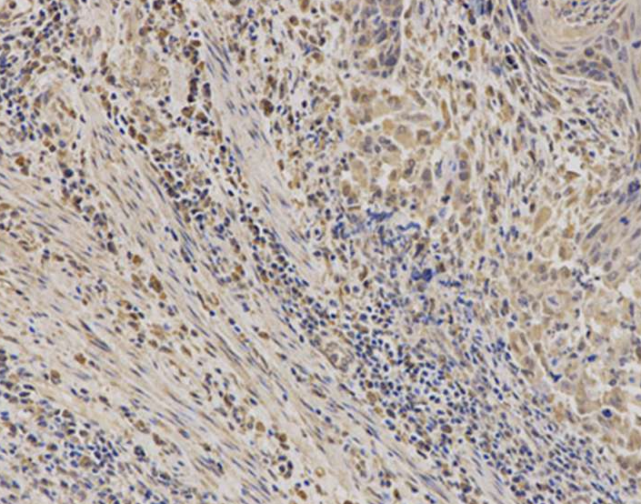 EPHX1 Rabbit Polyclonal Antibody