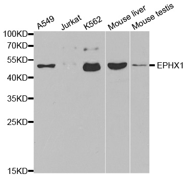 EPHX1 Rabbit Polyclonal Antibody