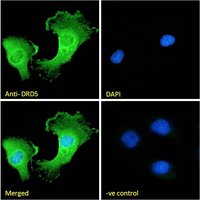 Goat anti-DRD5 Antibody