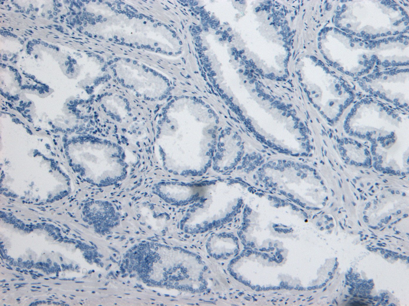 DPP4/CD26 Antibody