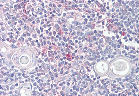 LITAF Antibody