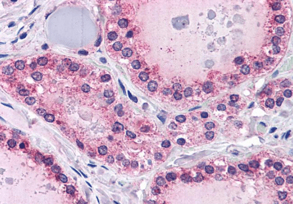 PTPRM Antibody