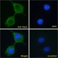 Trpv2 (mouse) Antibody